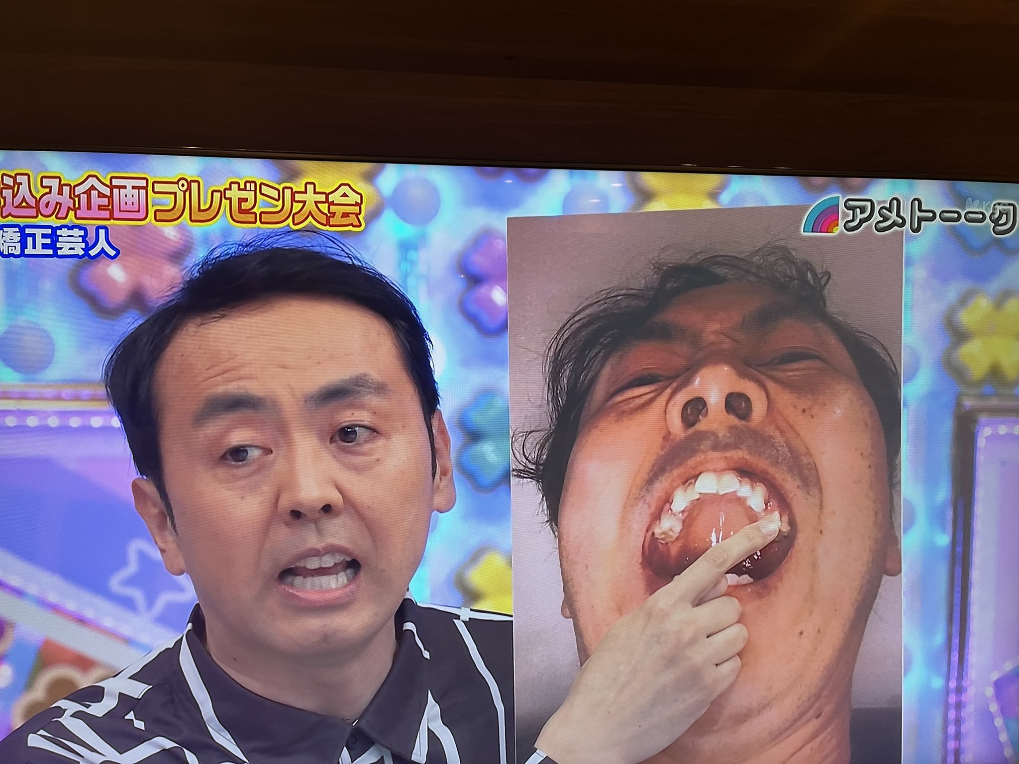 マウスピース矯正の芸能人を徹底調査！バレずに劇的変化した理由と真相