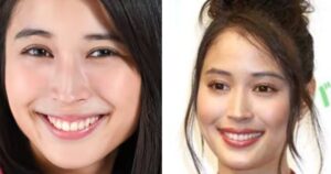 広瀬アリスの「顔変わった」噂を検証！整形疑惑とビジュアル激変の真相