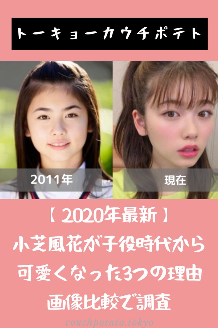 小芝風花はなぜ「ブス」と検索される？可愛くない説の真相と垢抜けの全貌