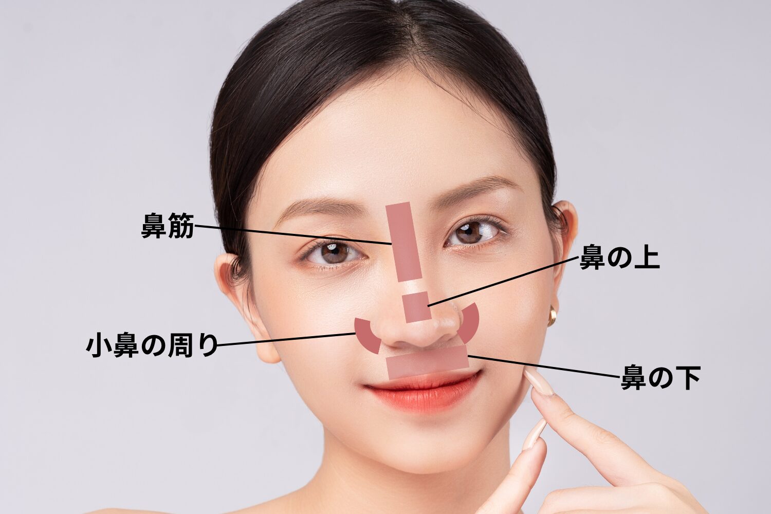 鼻の横ニキビの正体とは？痛いしこり・面疔の見分け方と最新治療法