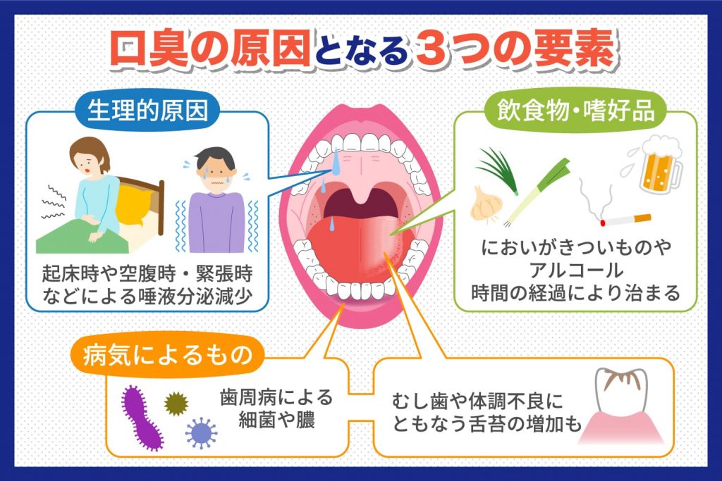 なぜ気づけない？口臭の根本原因と2026年最新おすすめケア徹底比較