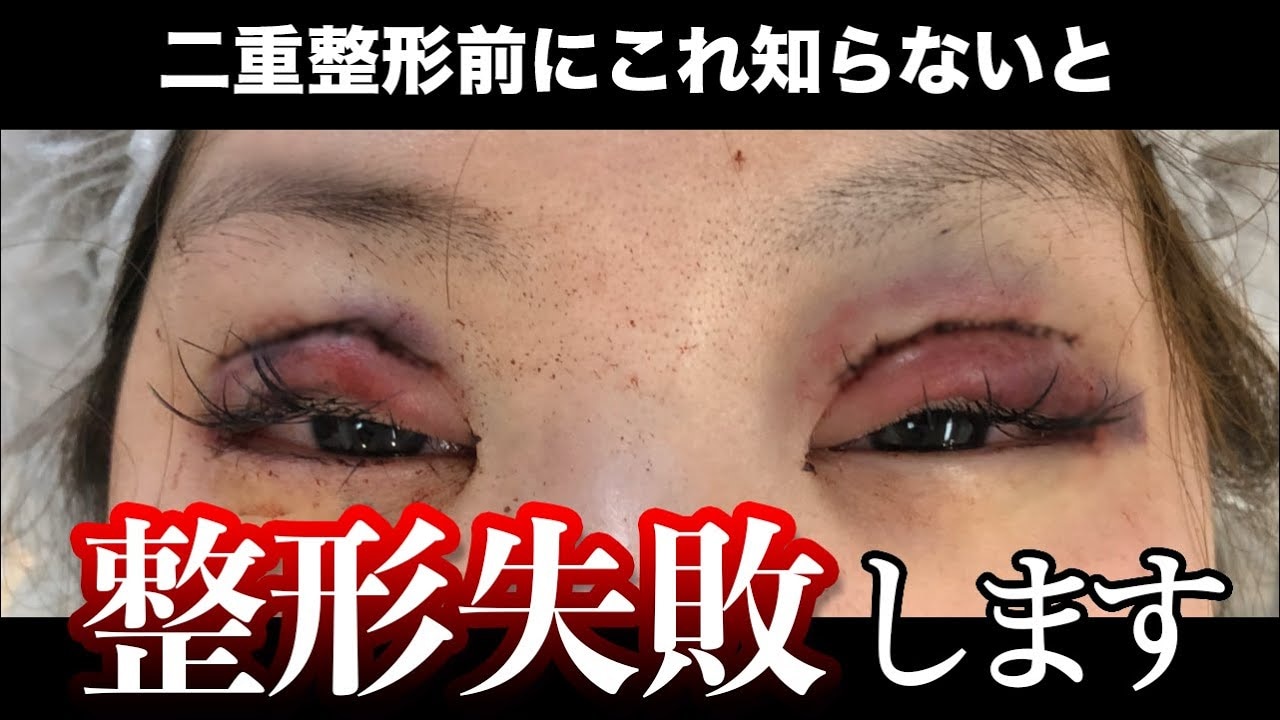 湘南美容外科カウンセリングの真相！無料相談だけで帰れるか徹底検証