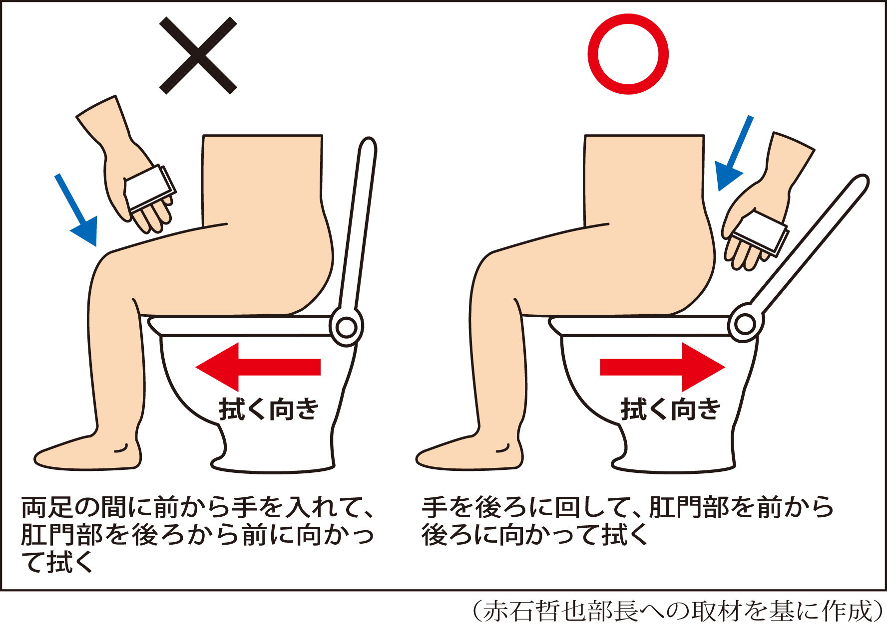 実は9割が勘違い？医師推奨のおしりの拭き方と痔・膀胱炎の予防術