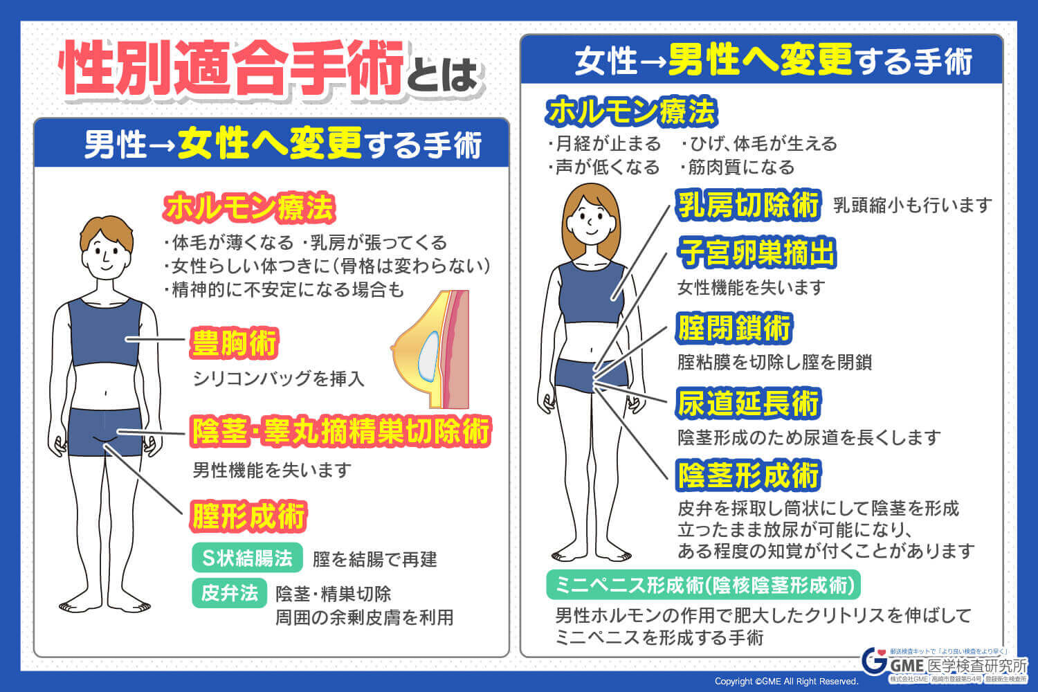 女性から男性への性転換｜費用と手術手順・戸籍変更の2026年最新事情