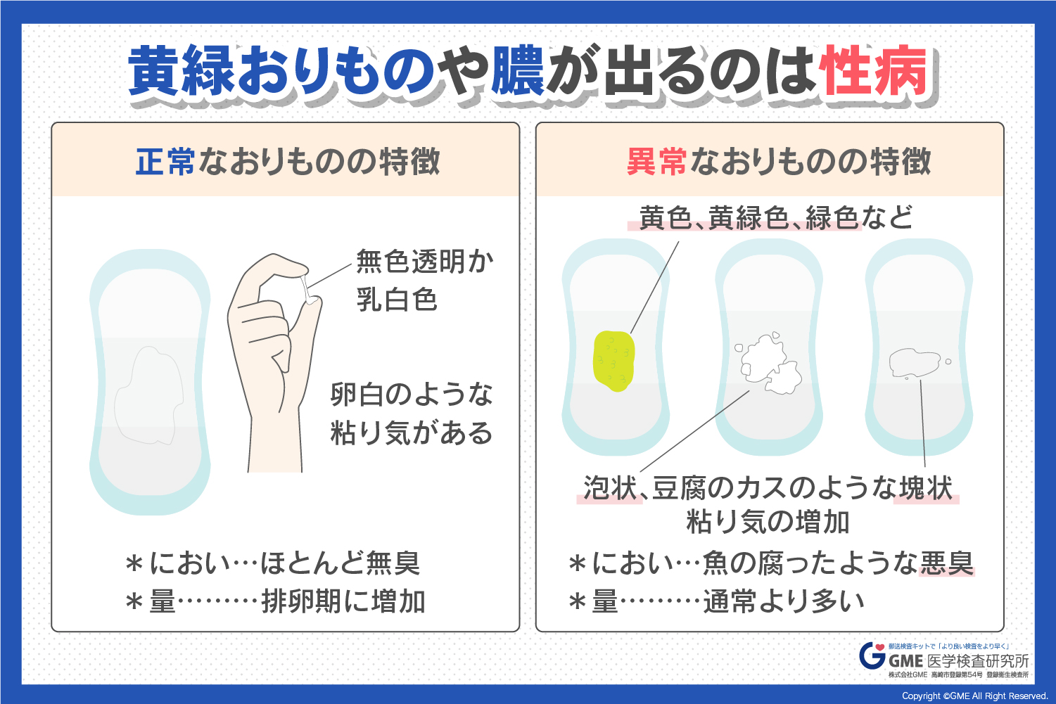 黄緑色で泡立つ異変の正体は？トリコモナスおりものの特徴と治療の真相