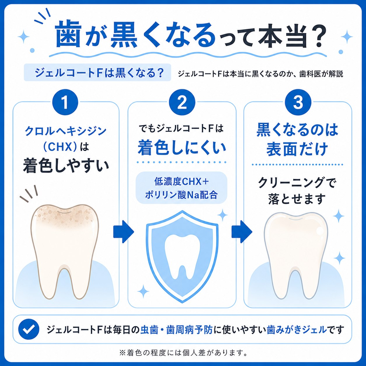 ジェルコートFで歯が黒くなる？噂の真相とステイン対策を徹底検証