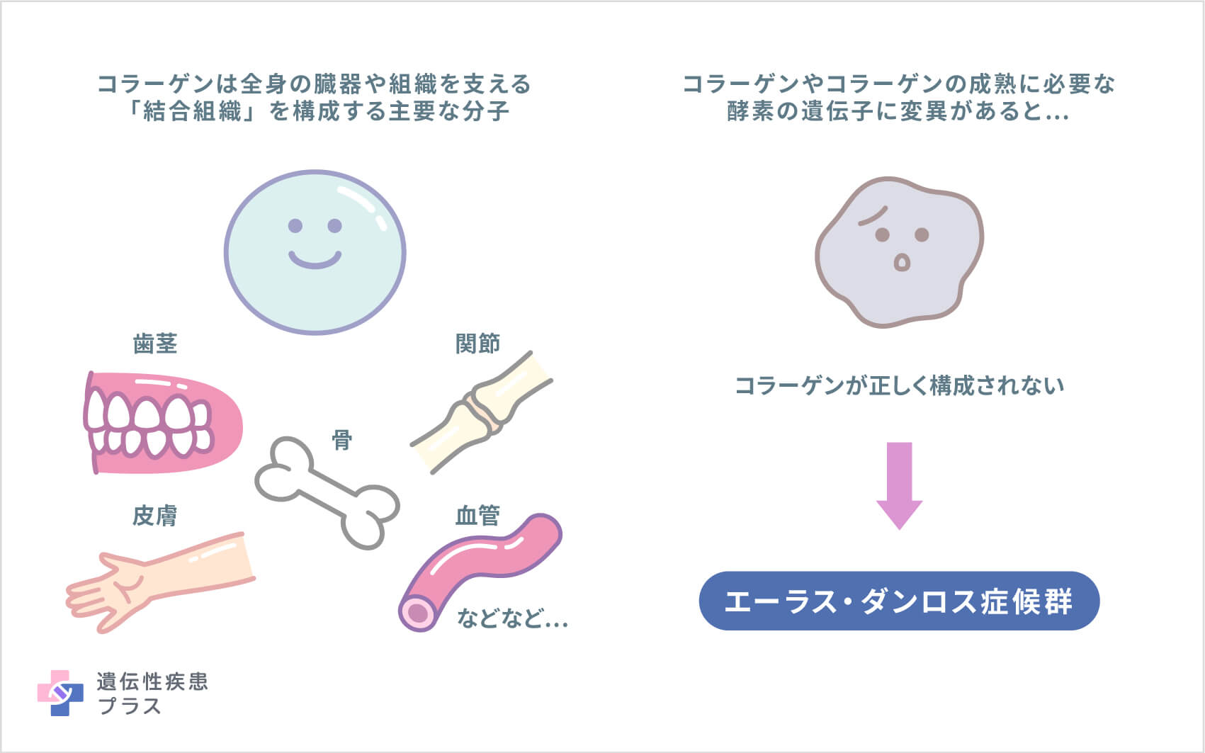皮膚が伸び関節が外れる？エーラスダンロス症候群の症状とタイプ別特徴