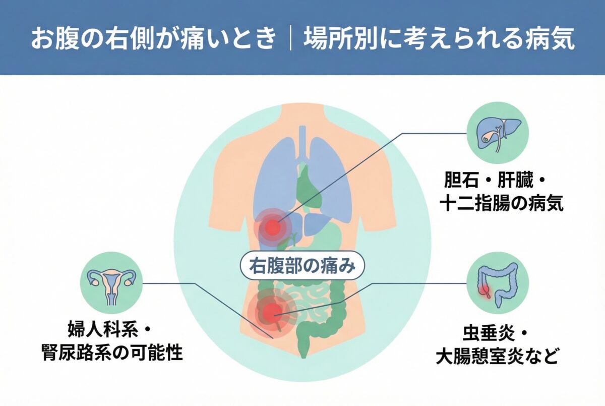 右のお腹が痛い原因は？危険な盲腸・胆石の兆候と受診科目を徹底解説