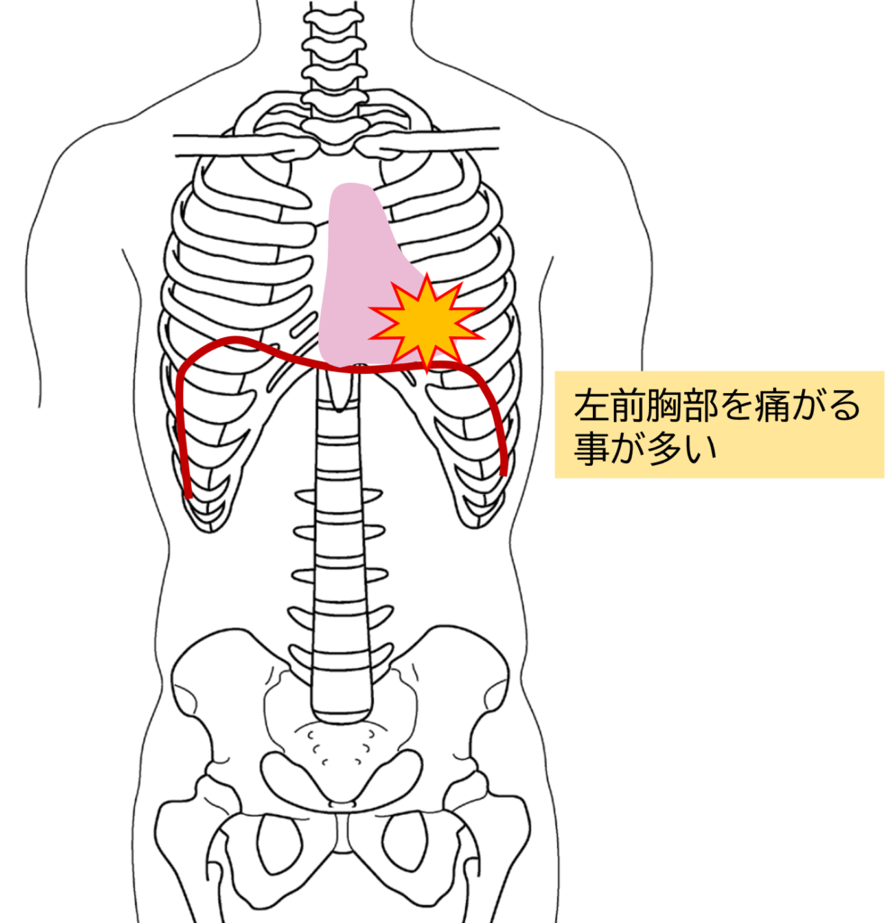 息を吸うと胸がチクッ…プレコーディアルキャッチ症候群の原因と対処法