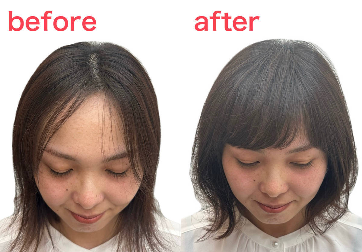 女性の前髪が薄くなる原因と真相｜2026年最新の改善策と隠し方
