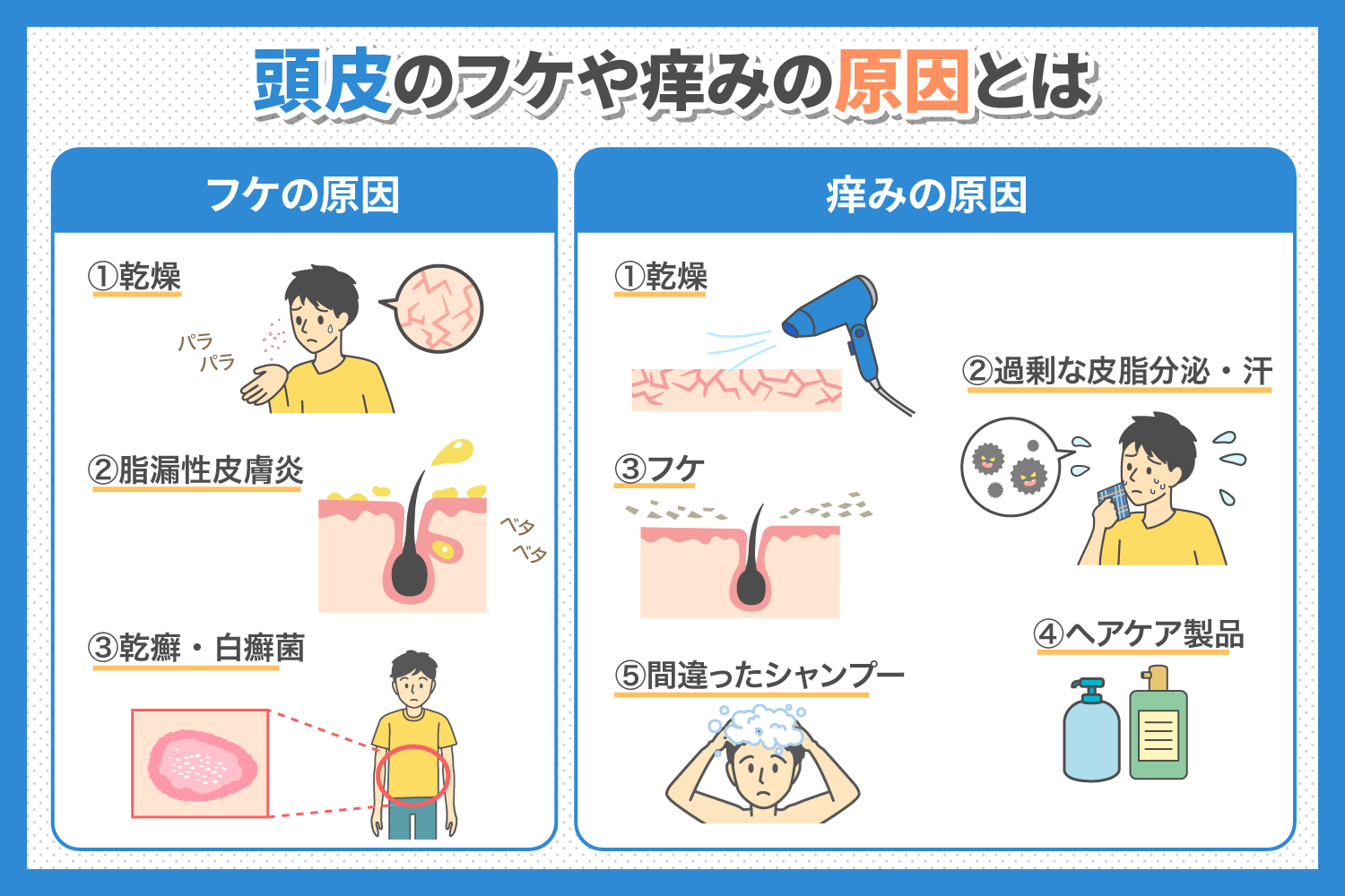 なぜ頭皮のかゆみ・フケは治らない？逆効果なNg習慣と改善策の真相を徹底解説