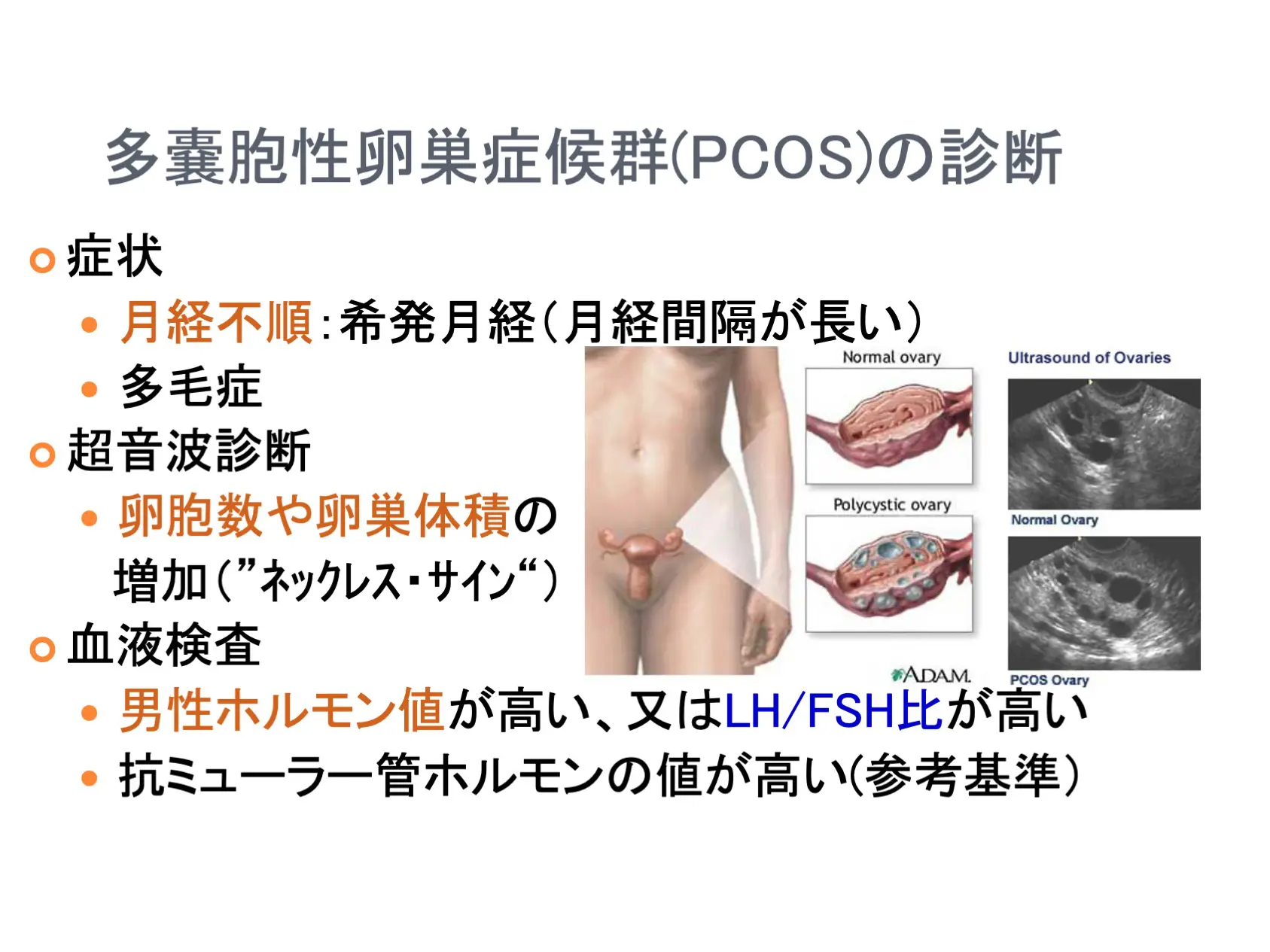 女性の多毛症の画像と原因とは？Pcosや治療法を専門医視点で徹底解説