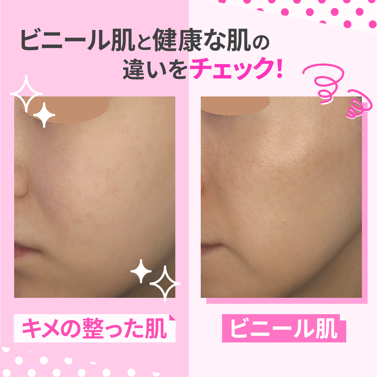 ビニール肌とは？ツヤ肌との決定的な違い・原因と正しい改善ケアの全貌