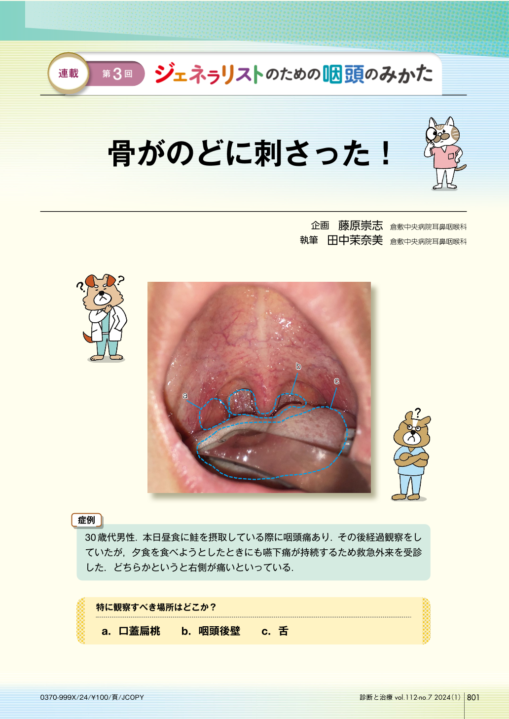 喉に魚の骨が刺さったらご飯丸呑みは危険？専門医が明かす正しい対処法