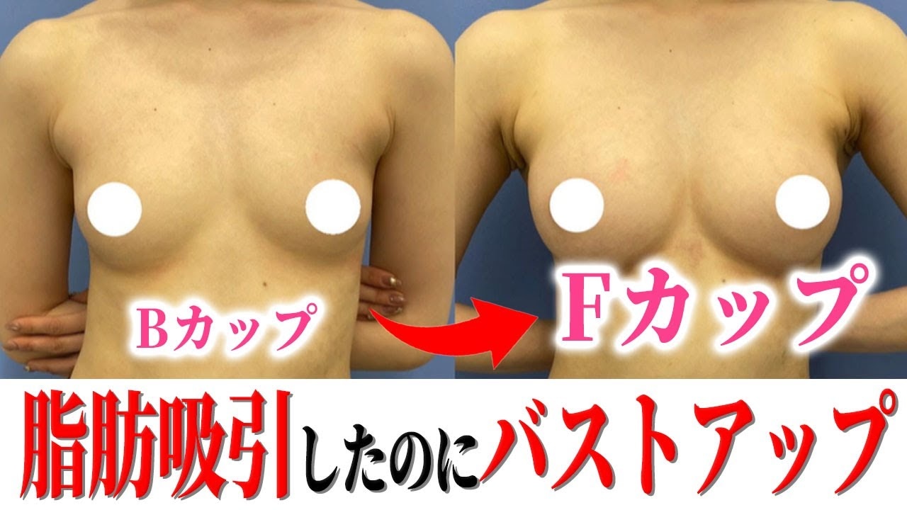 Bカップの胸は小さい？見た目や重さの真実と男性の本音を徹底解剖