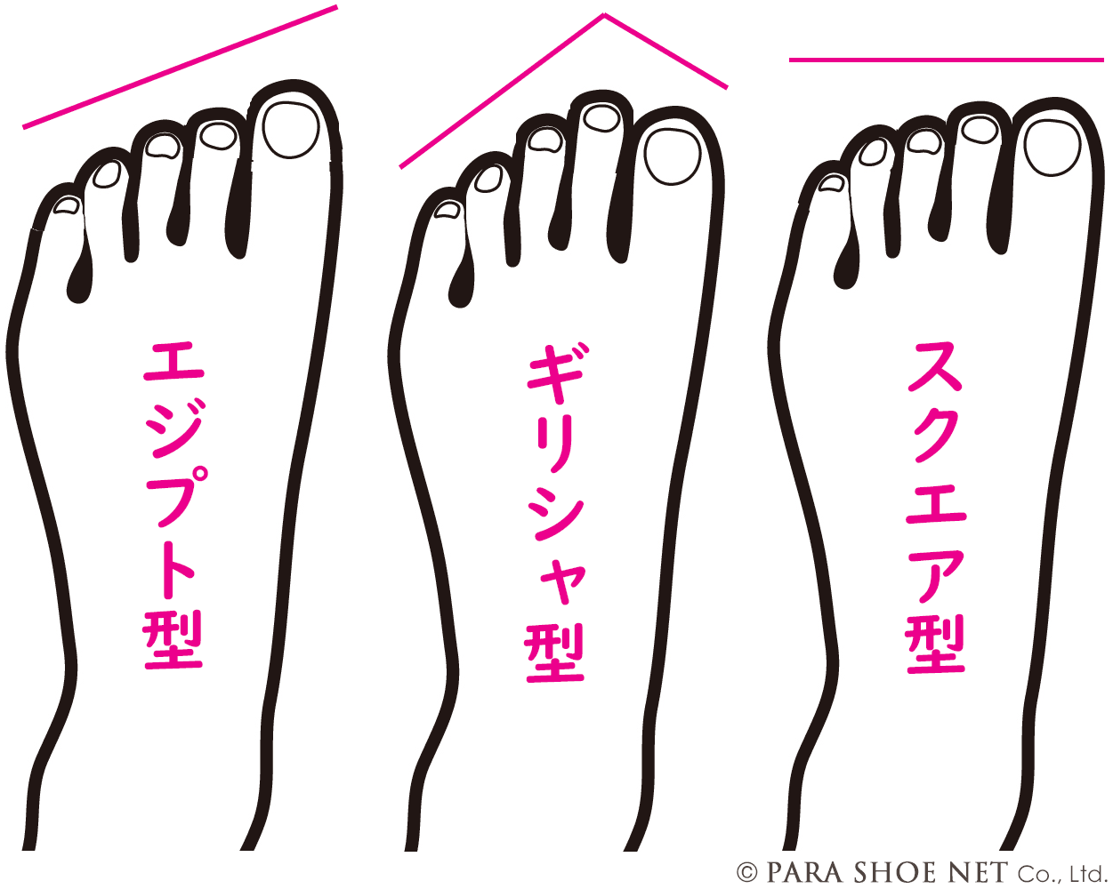 エジプト型の足の特徴とは？性格傾向と外反母趾を防ぐ靴選びを解説