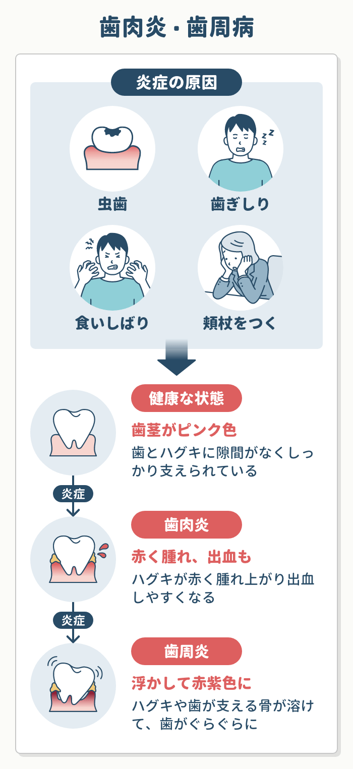 歯茎の腫れに効く市販薬の口コミ検証！即効性の真偽と正しい選び方