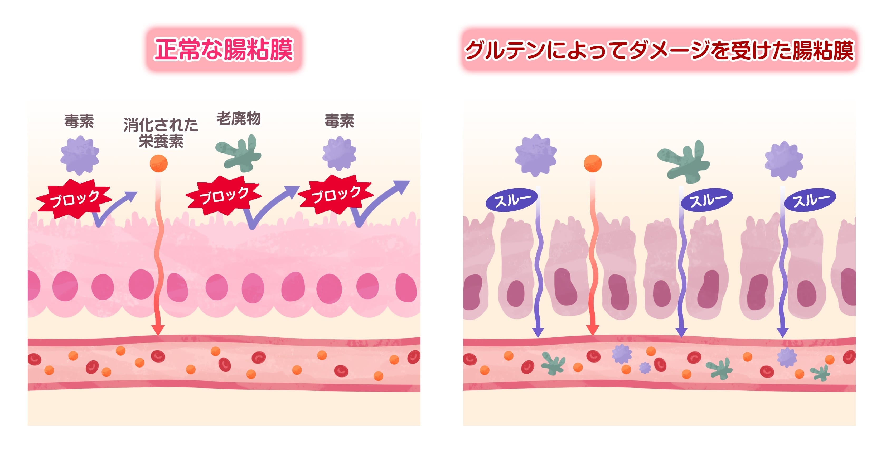 グルテンは何が悪い？体調不良の正体と小麦粉が及ぼす影響を徹底検証