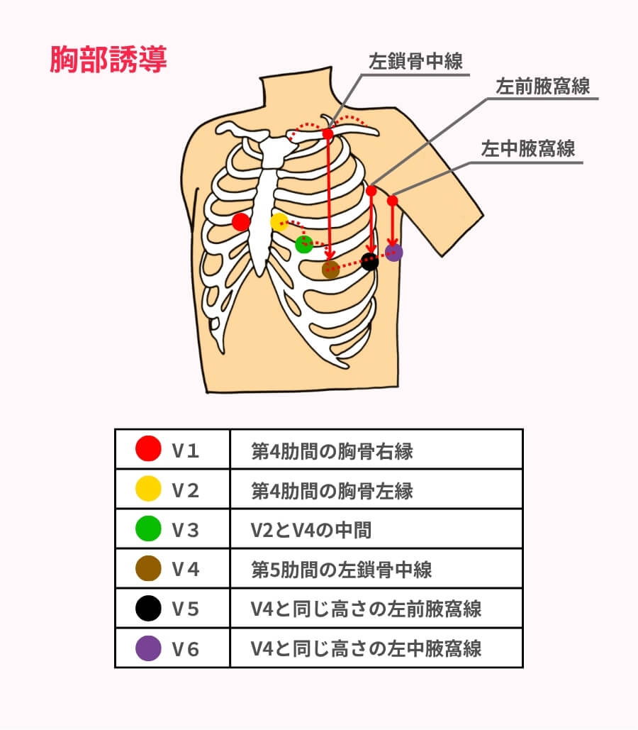 12誘導心電図の貼り方と読み方完全解説｜電極位置とSt変化の要点