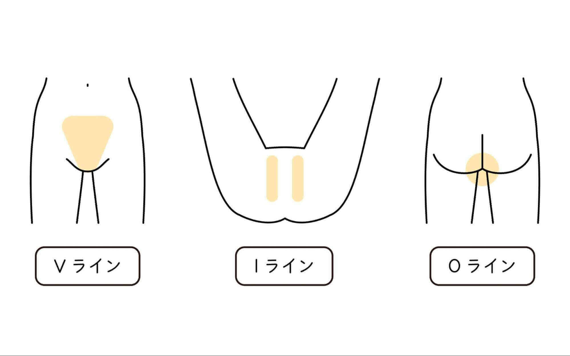 Vio自己処理のやり方完全版！チクチクやかゆみを防ぐプロ直伝の剃り方