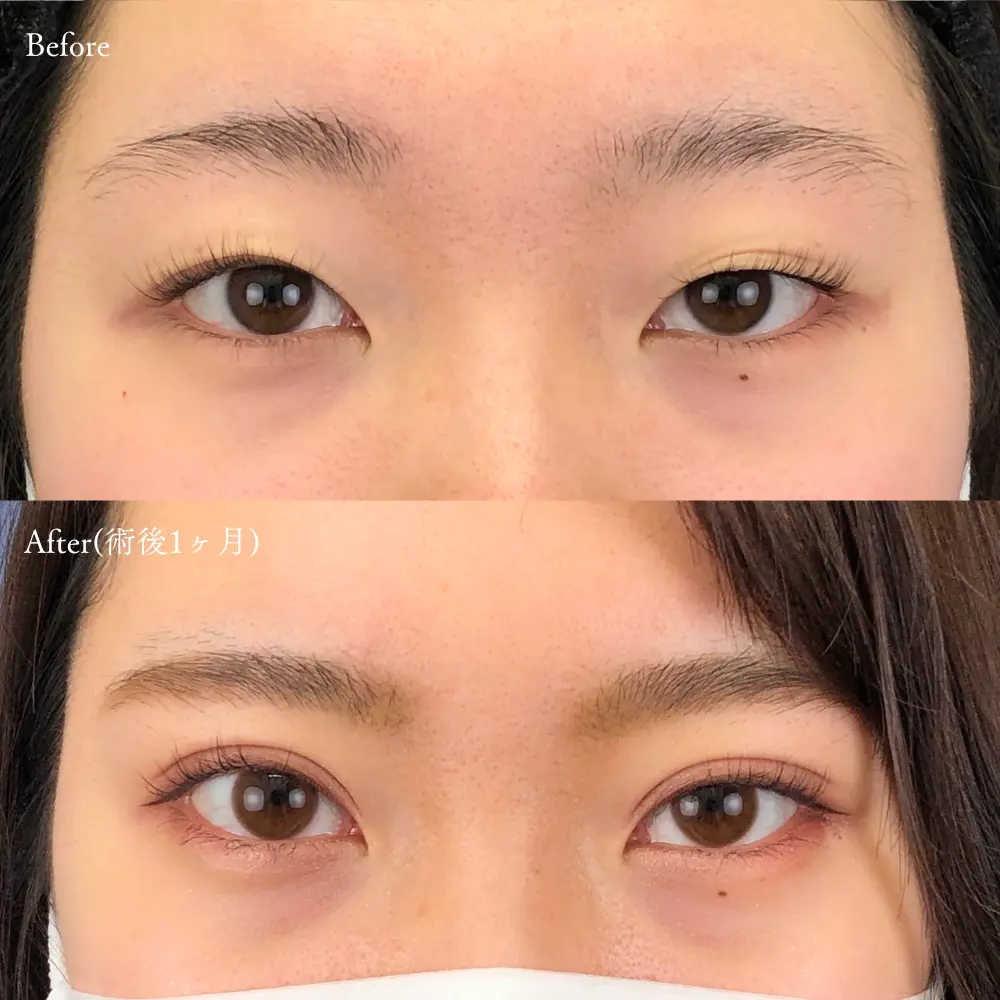 雌雄眼が人を惹きつける理由｜人相学の天才肌説と左右差メイクの真相
