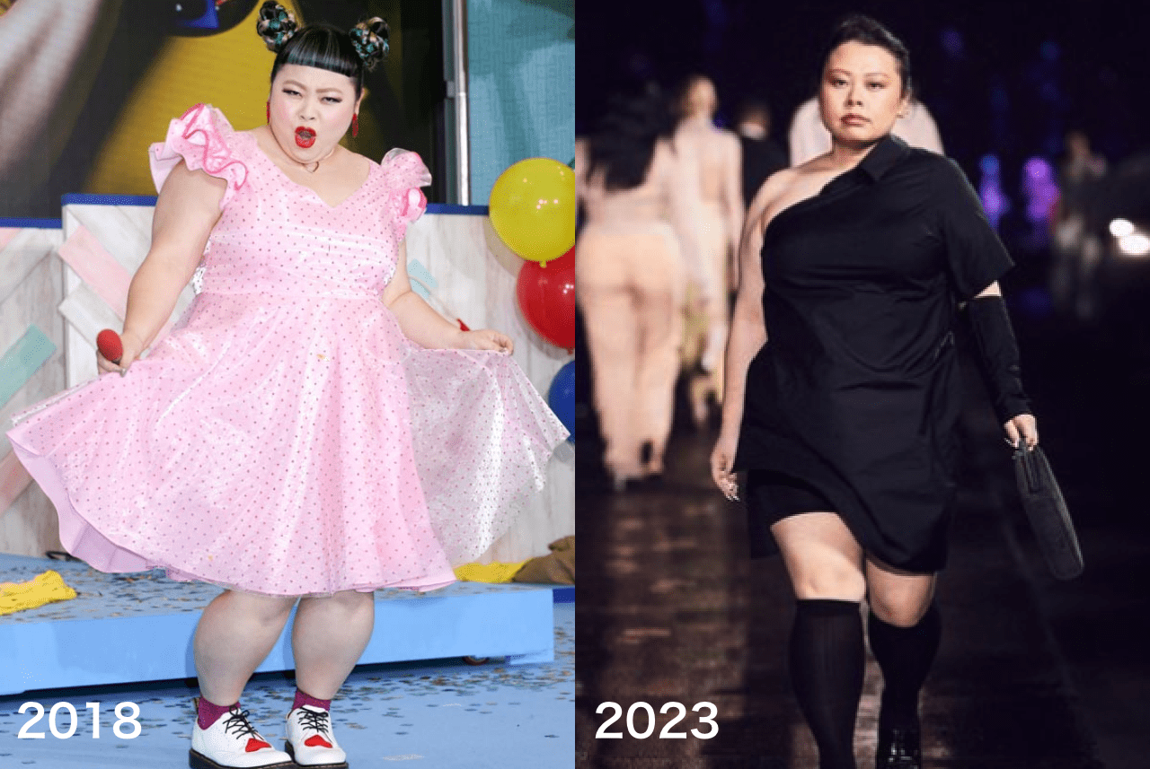 渡辺直美が20Kg痩せた真相！激変の理由と現在の体重推移を徹底解明