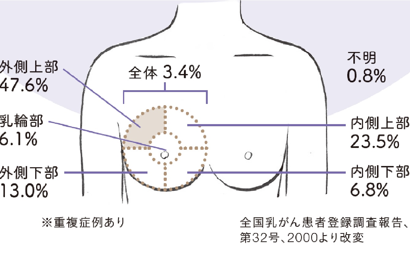 胸がチクチク痛む原因は？危険な心臓病の見分け方と受診科の目安