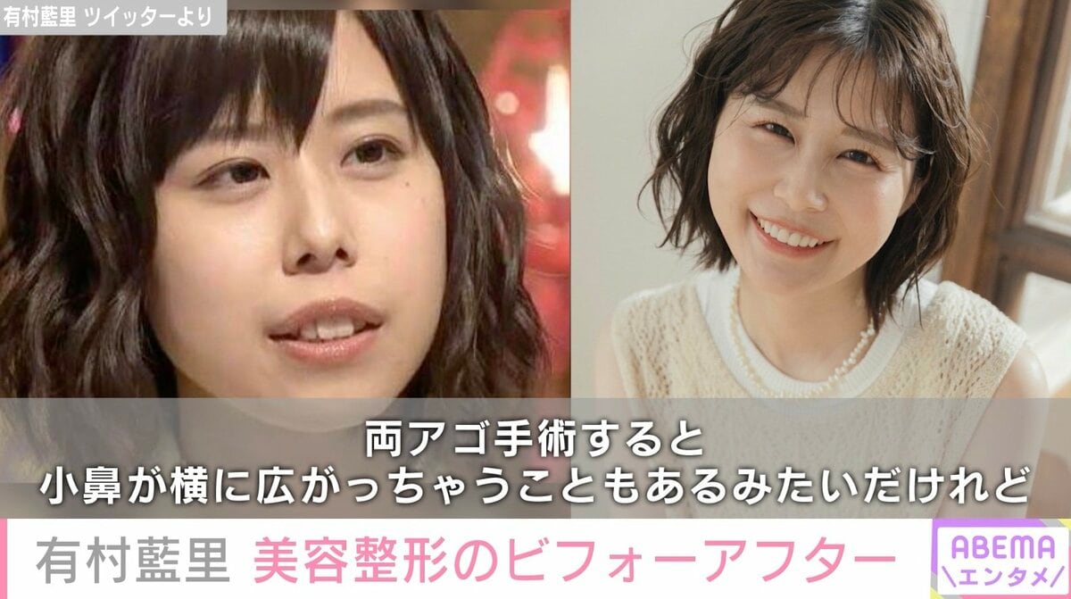 アップノーズ芸能人徹底解剖！豚鼻との違いと愛される美の黄金比2026