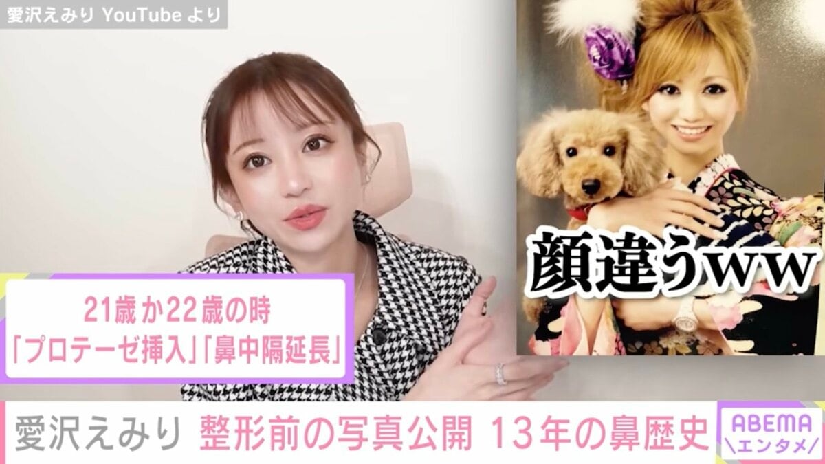 愛沢えみりの整形前と現在を比較！昔の写真や施術箇所を徹底解明