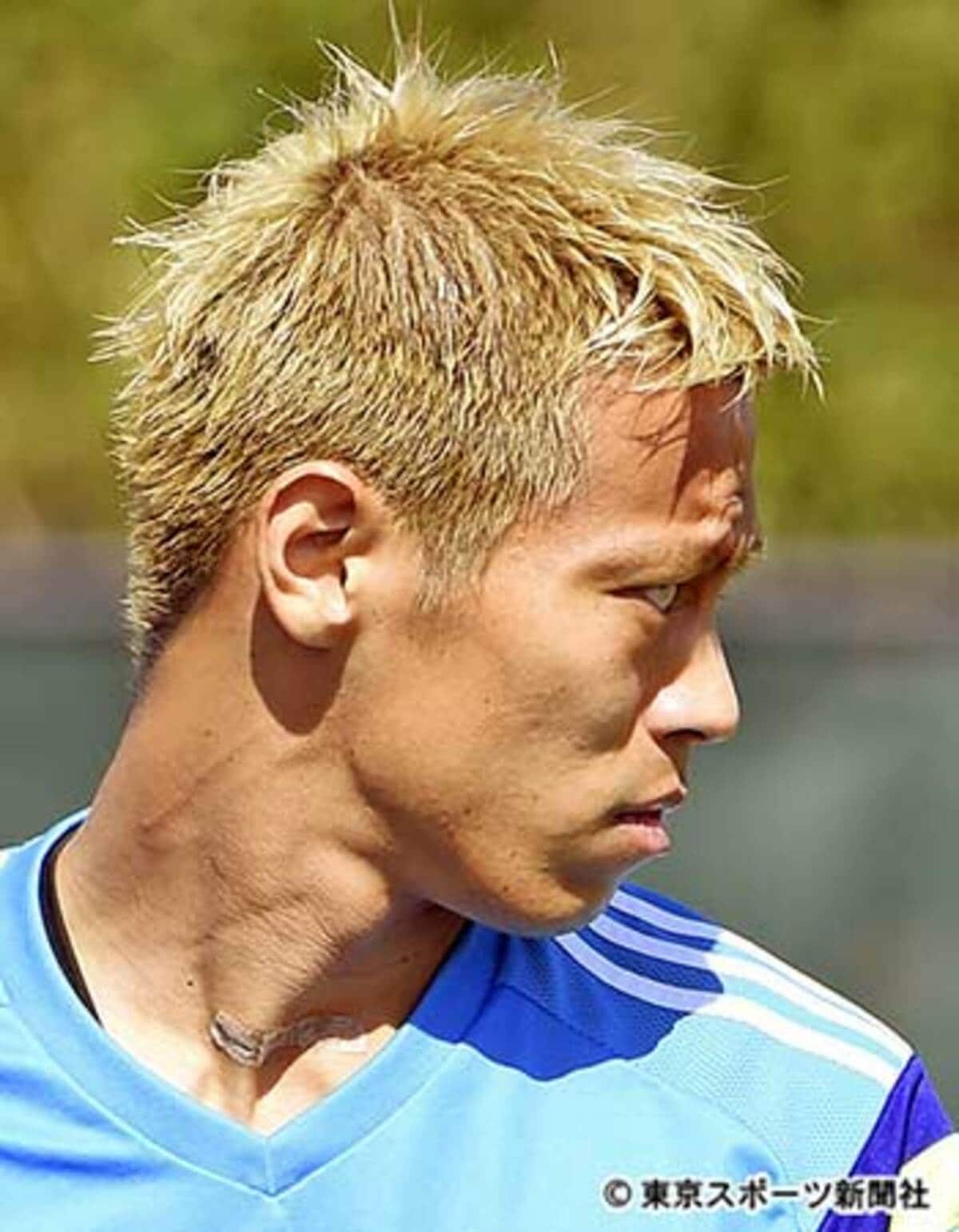 本田圭佑のバセドウ病疑惑の真相！首の手術痕と目の変化の理由【2026】