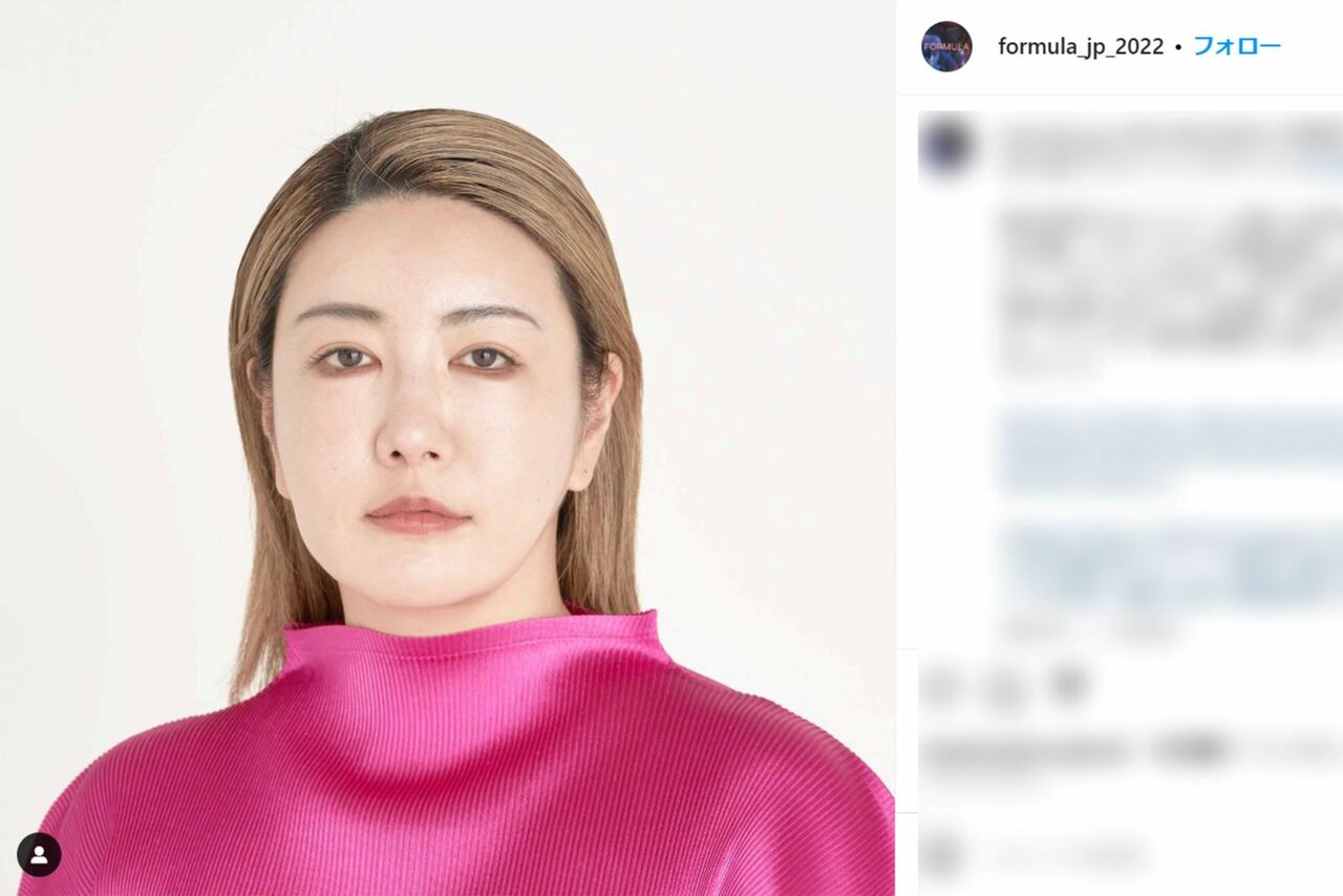 中野信子の整形疑惑を検証！昔と現在の顔変化とウィッグの真相