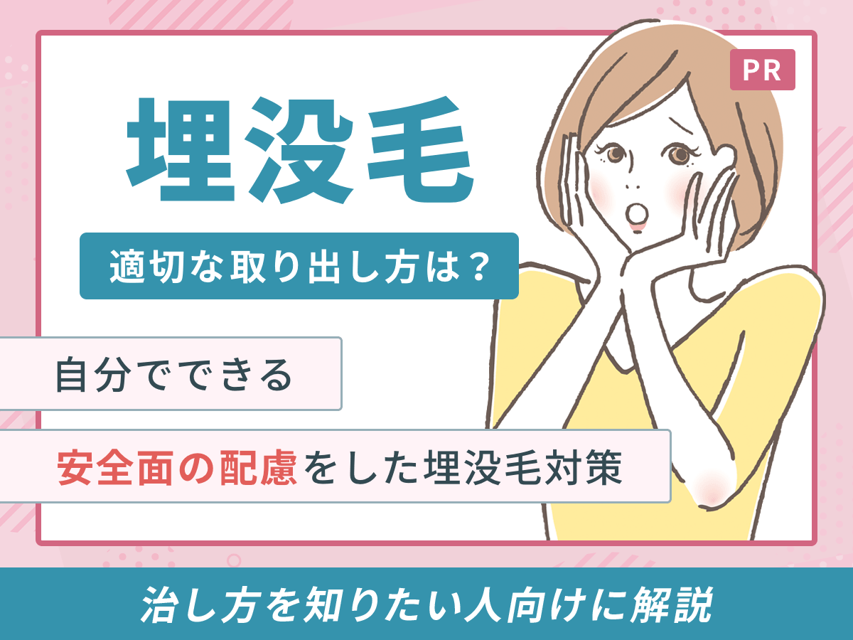 埋没毛の安全な取り出し方｜針や毛抜きNgの理由と跡を残さないケア手順
