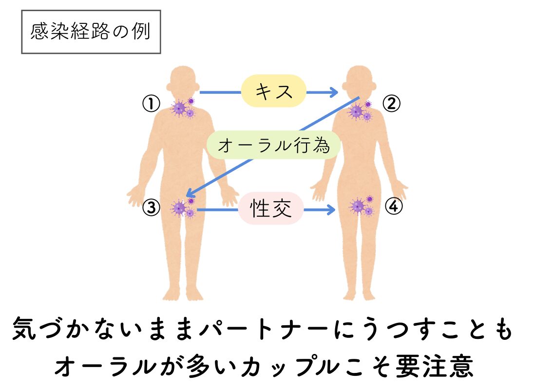 口腔カンジダはキスでうつるのか？性病疑惑の真相と感染リスク