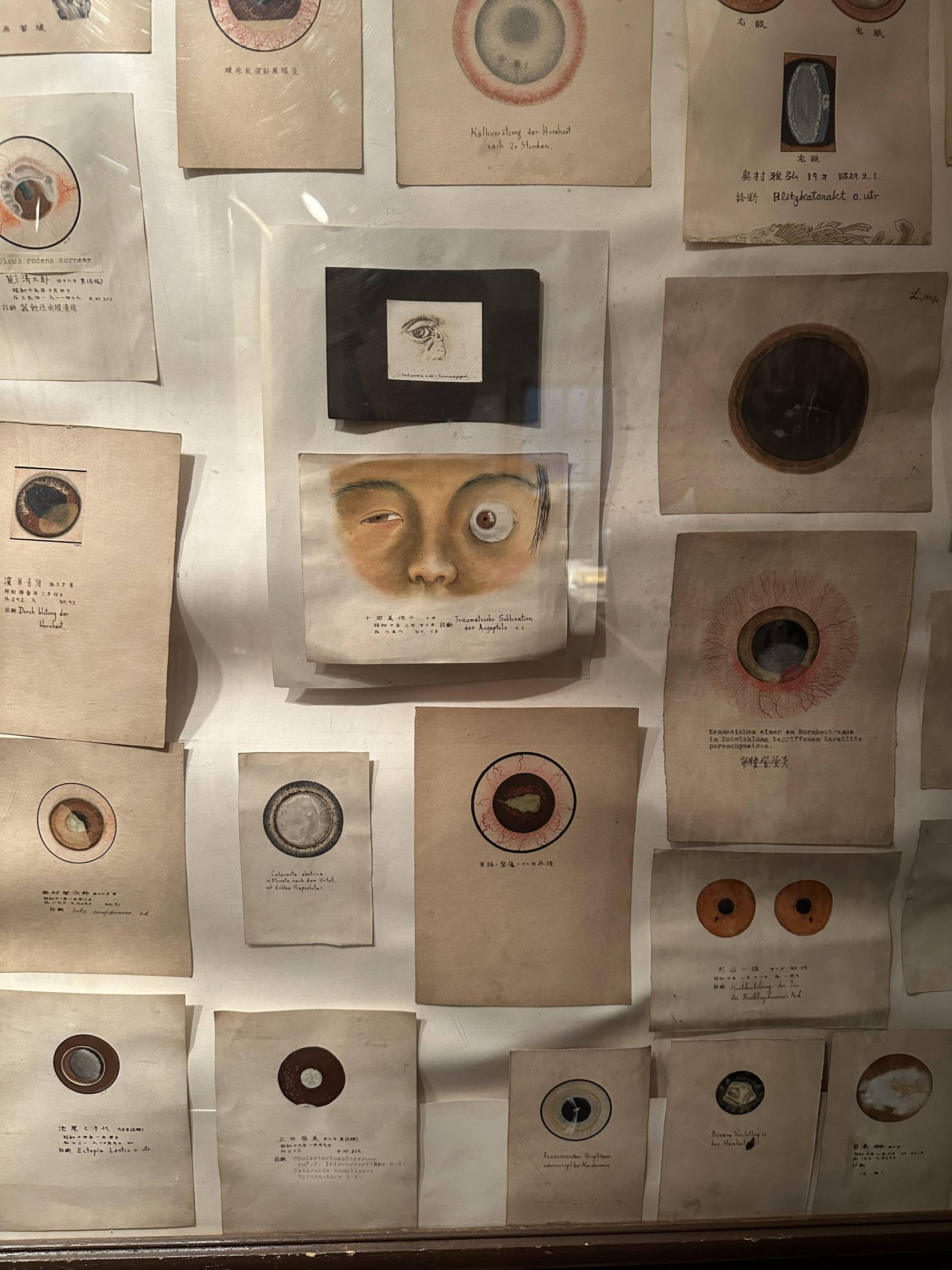 昔の手術道具に驚愕！眼科・外科医療器具の歴史と実物が見られる博物館