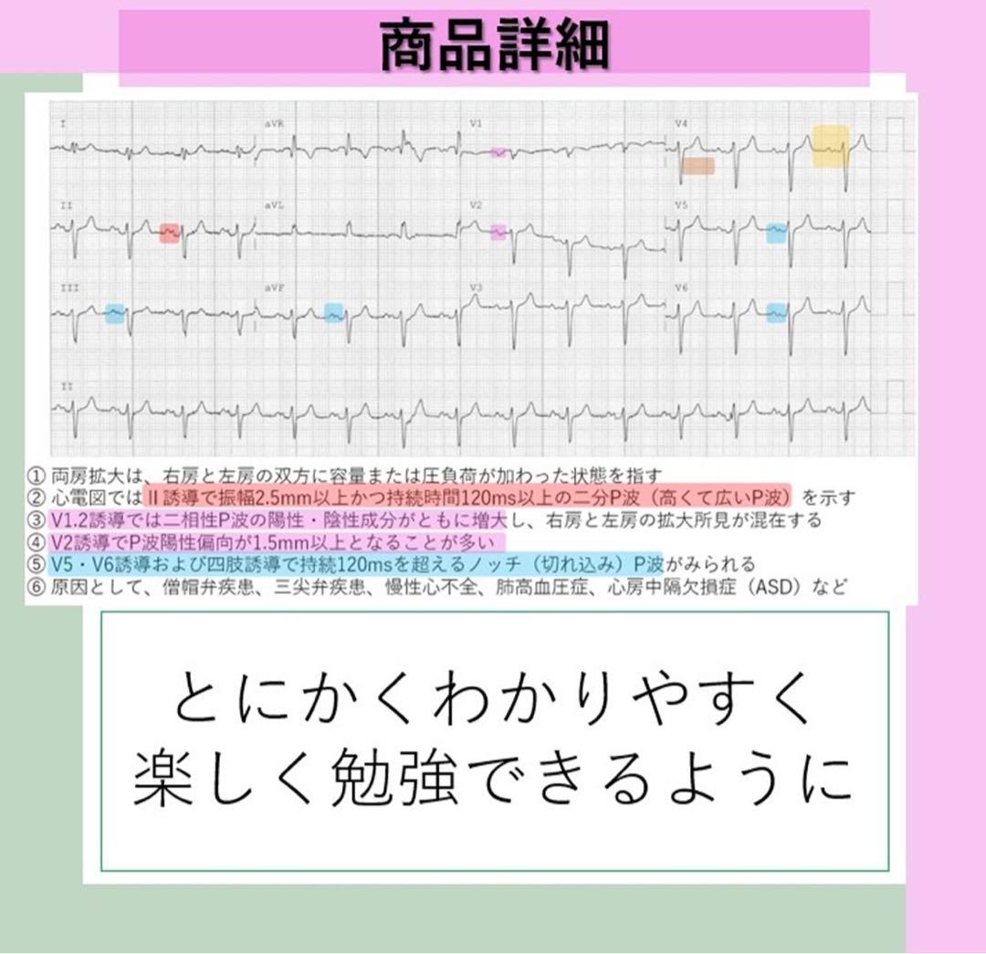 心電図検定4級の過去問は非公開？出題傾向と一発合格勉強法2026