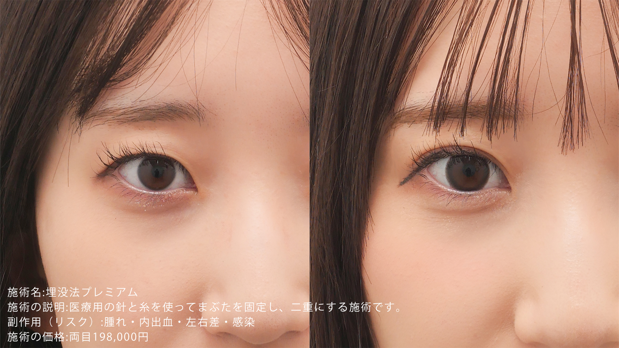 目頭が丸い芸能人の愛され顔の秘密｜橋本環奈・有村架純の目元分析