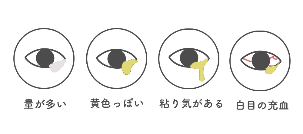 朝起きると片目だけ目やにが出る原因とは？色別の危険サインと正しい対処法