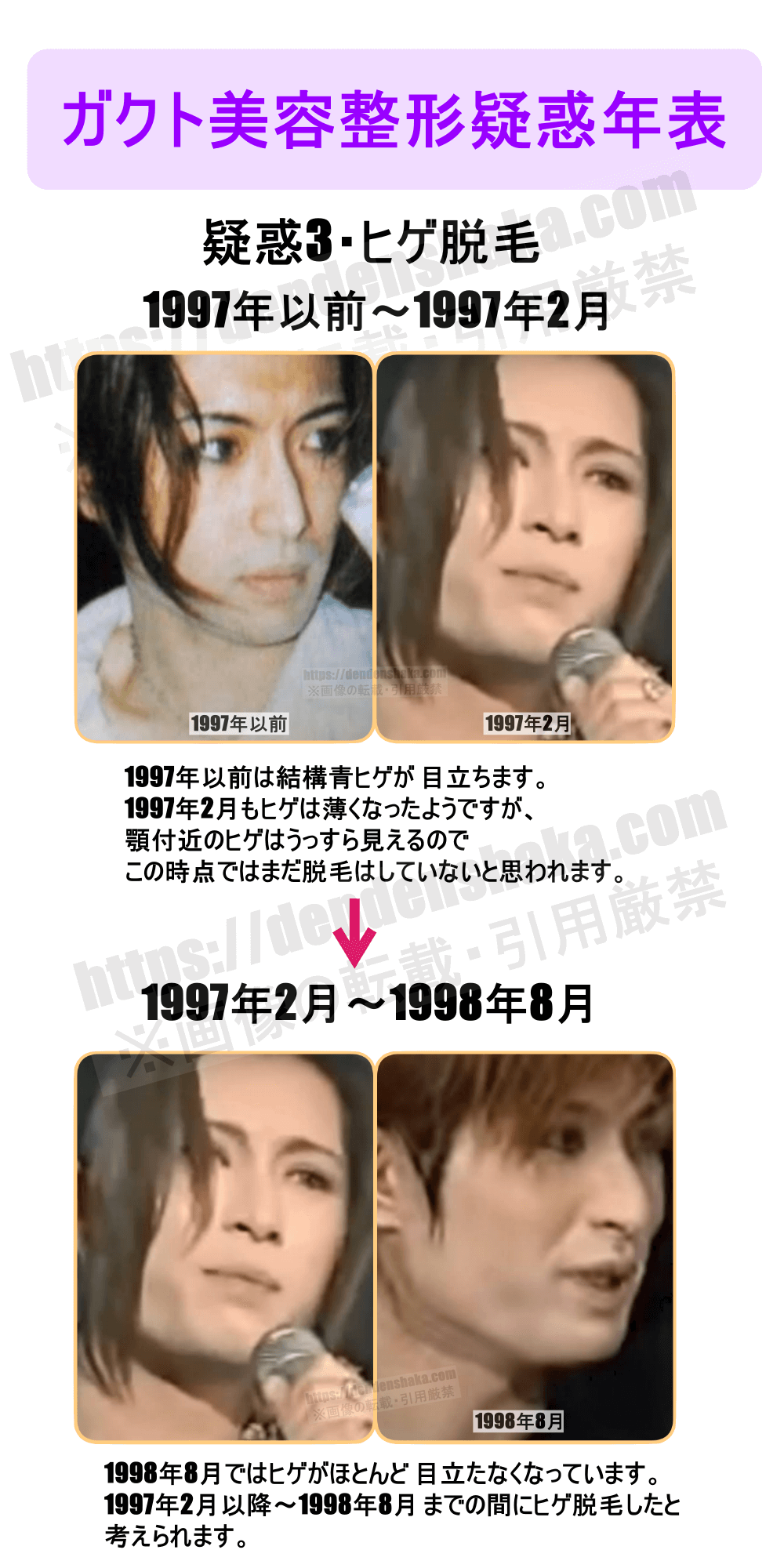 Gacktの目が変な真相とは？整形疑惑・カラコンと持病の全貌を検証