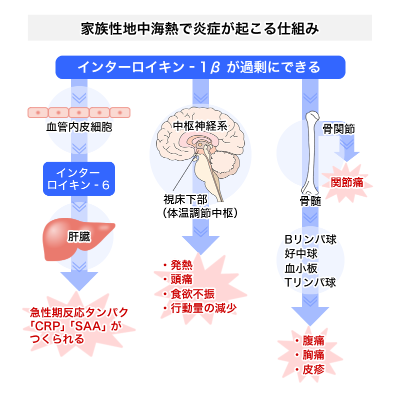 周期性発熱症候群はなぜ繰り返す？原因や症状と2026年最新治療法