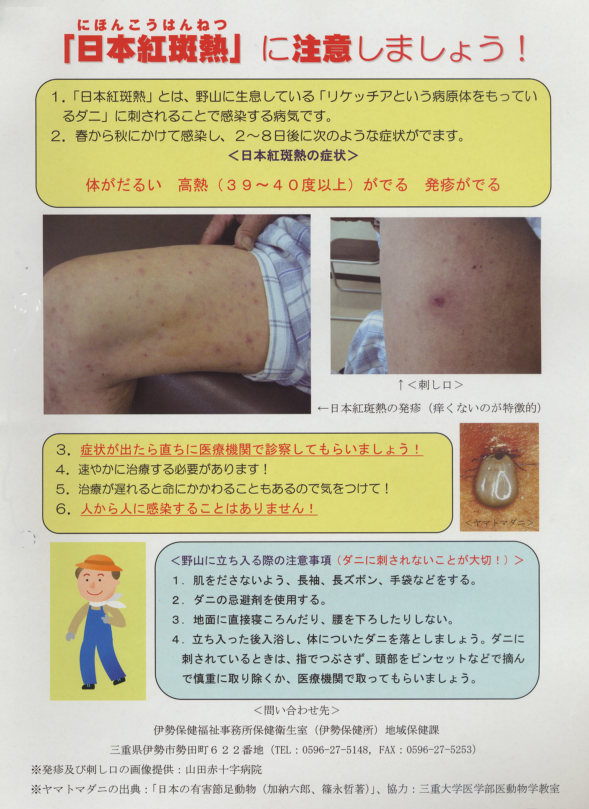 【知らないと命に関わる】ツツガムシ病の症状と致死率の真実
