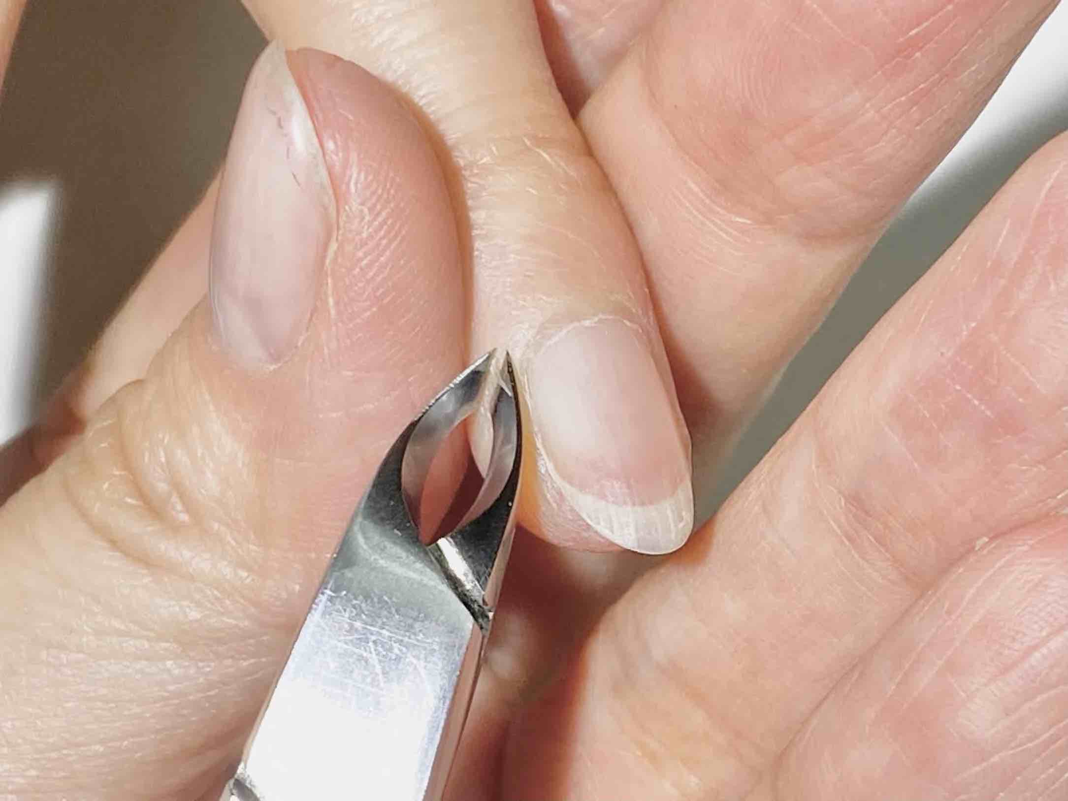 爪の横のささくれが痛む原因は？剥くNgと即効の治し方を徹底解説