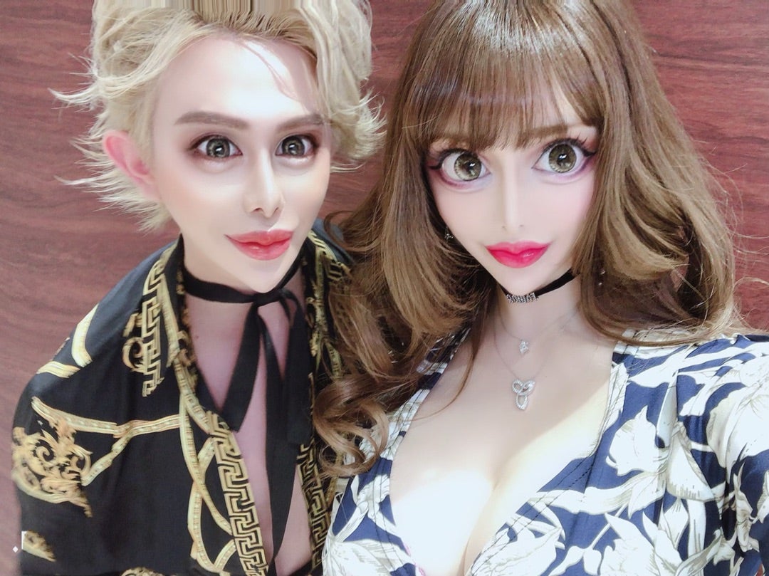 ヴァニラとアレンの写真徹底解剖！整形前後の変遷と現在