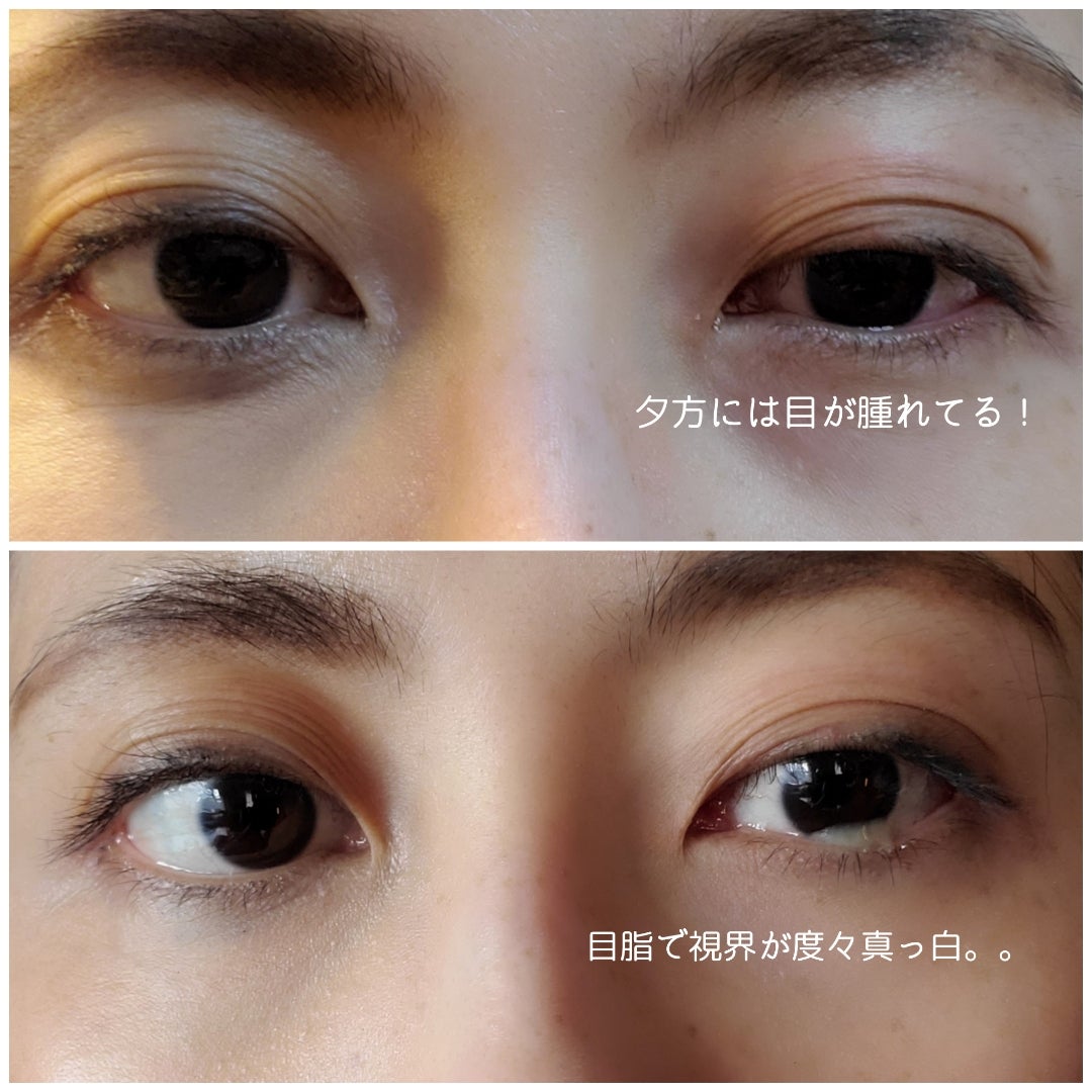 大人のアデノウイルス感染体験談！39度熱と喉激痛の実態と復帰目安