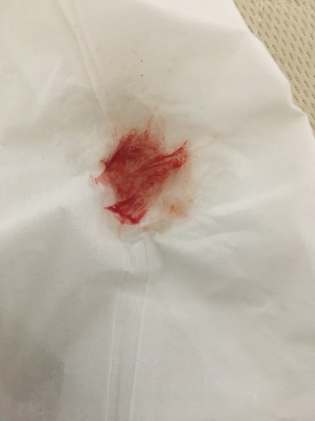痰に血が混じる原因を徹底解説！咳なし・色別の危険度と何科を受診すべきか