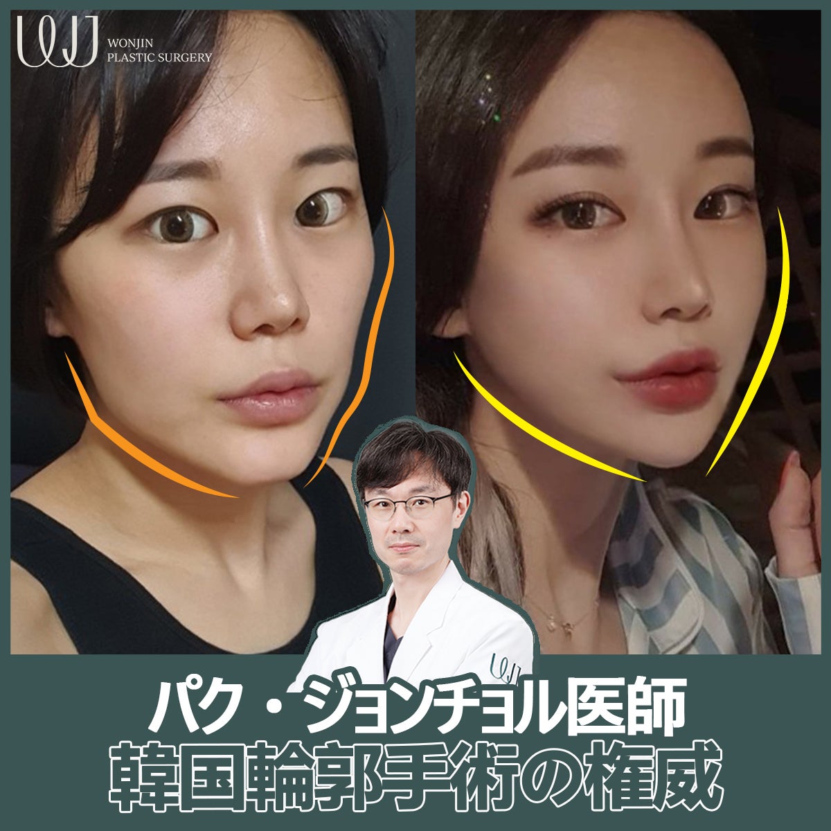 韓国プチ整形が選ばれる理由と費用相場｜失敗を防ぐ渡韓の全真相
