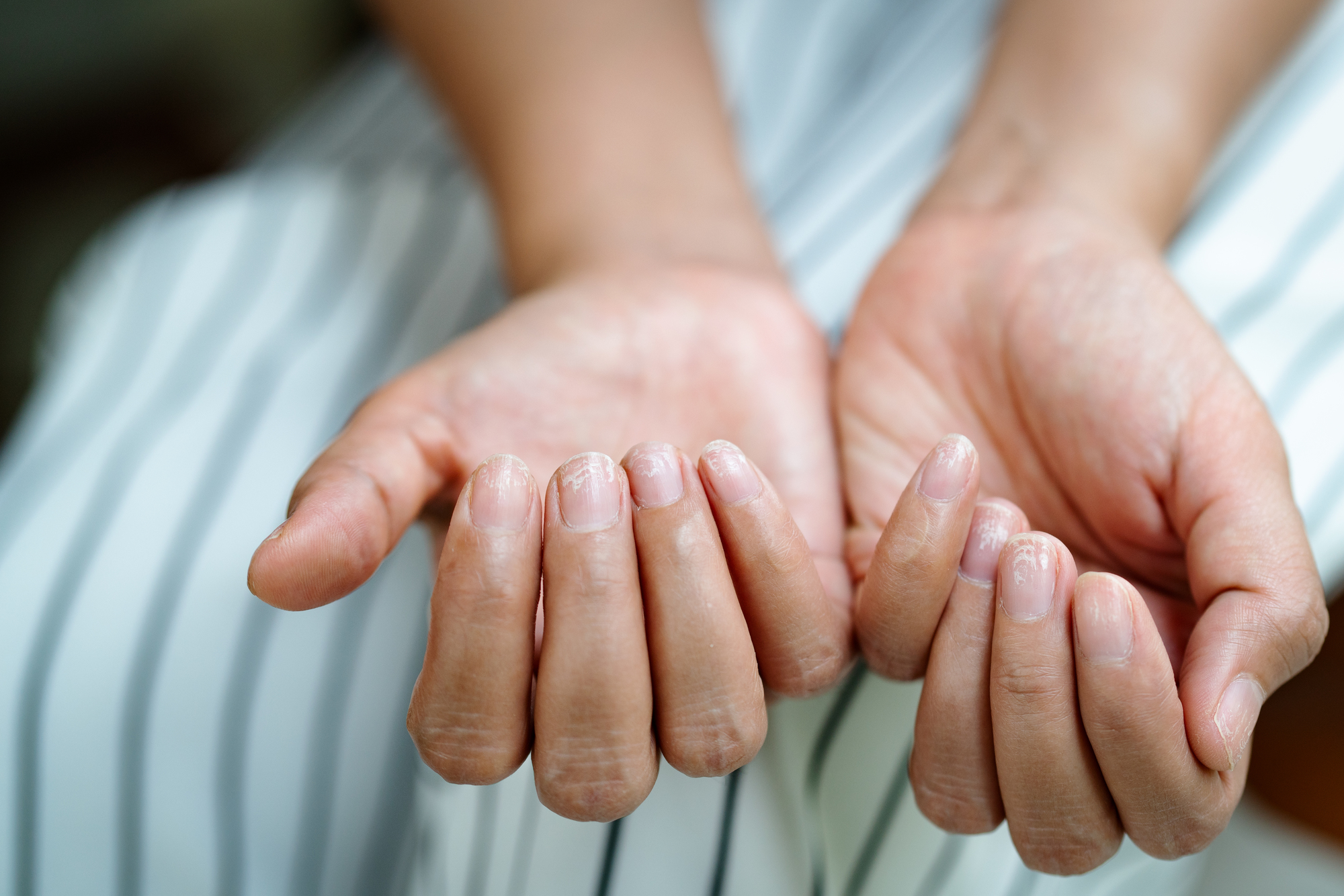 手のひらの赤い斑点で痒くない原因は？危険な病気サインと見分け方