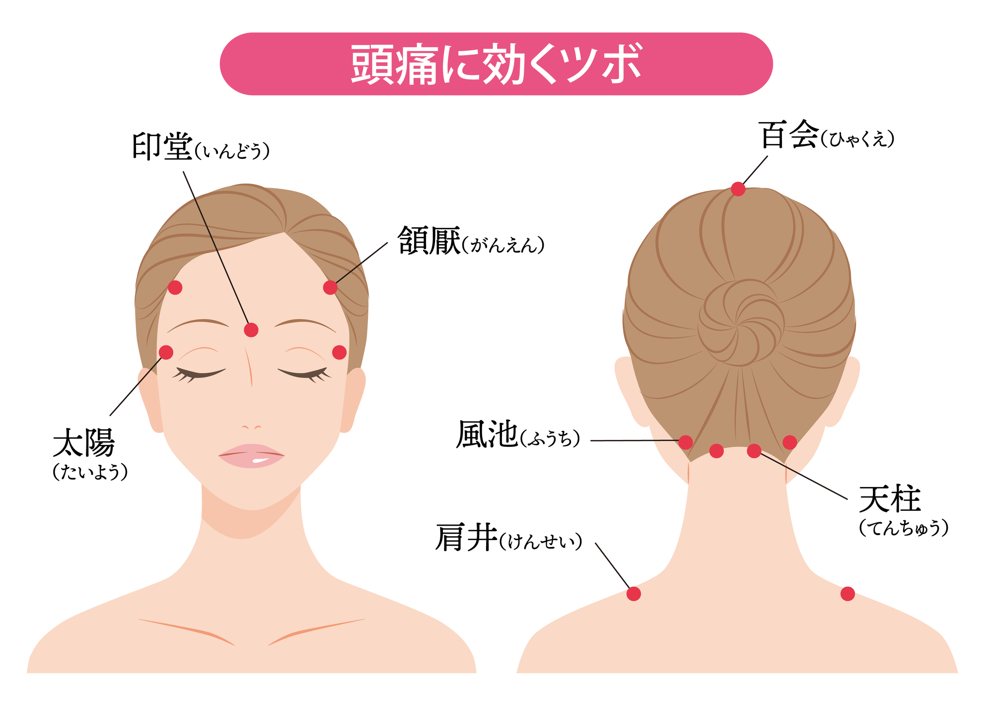 偏頭痛のツボ即効緩和法｜押してはいけない理由と正しい位置の全知識