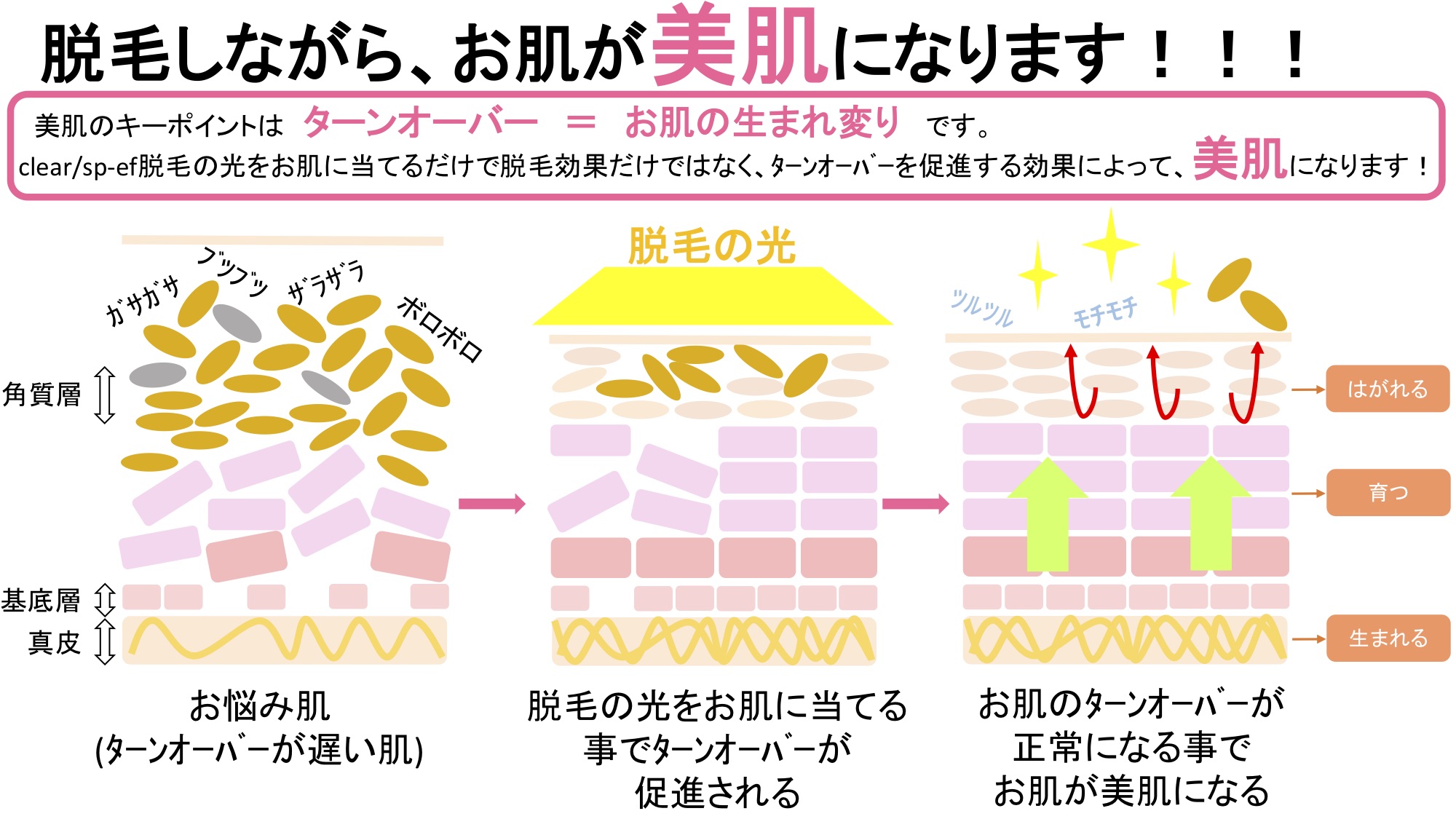 光フェイシャルとは？レーザーとの違いや効果・デメリットの真相を徹底解説