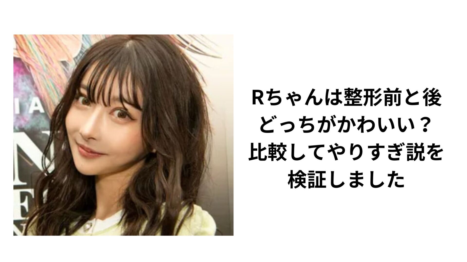 Rちゃんが明かした「整形前」の葛藤と3000万円のアップデート：美の美学と自己解放のリアル【2026年最新分析】