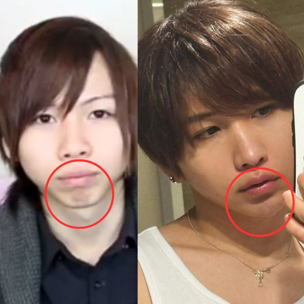 タケヤキ翔の整形疑惑を徹底検証！昔と現在の顔写真比較と本人の告白